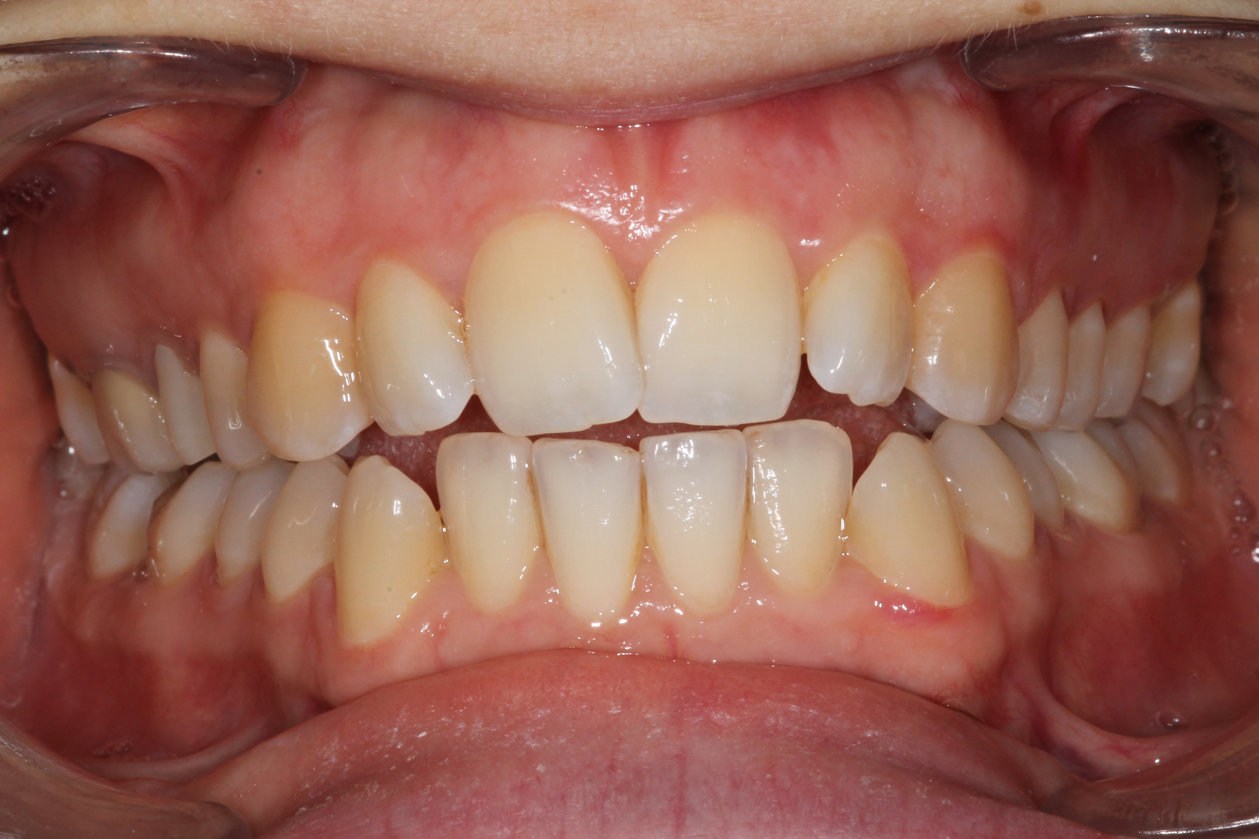 Photo ortho 1