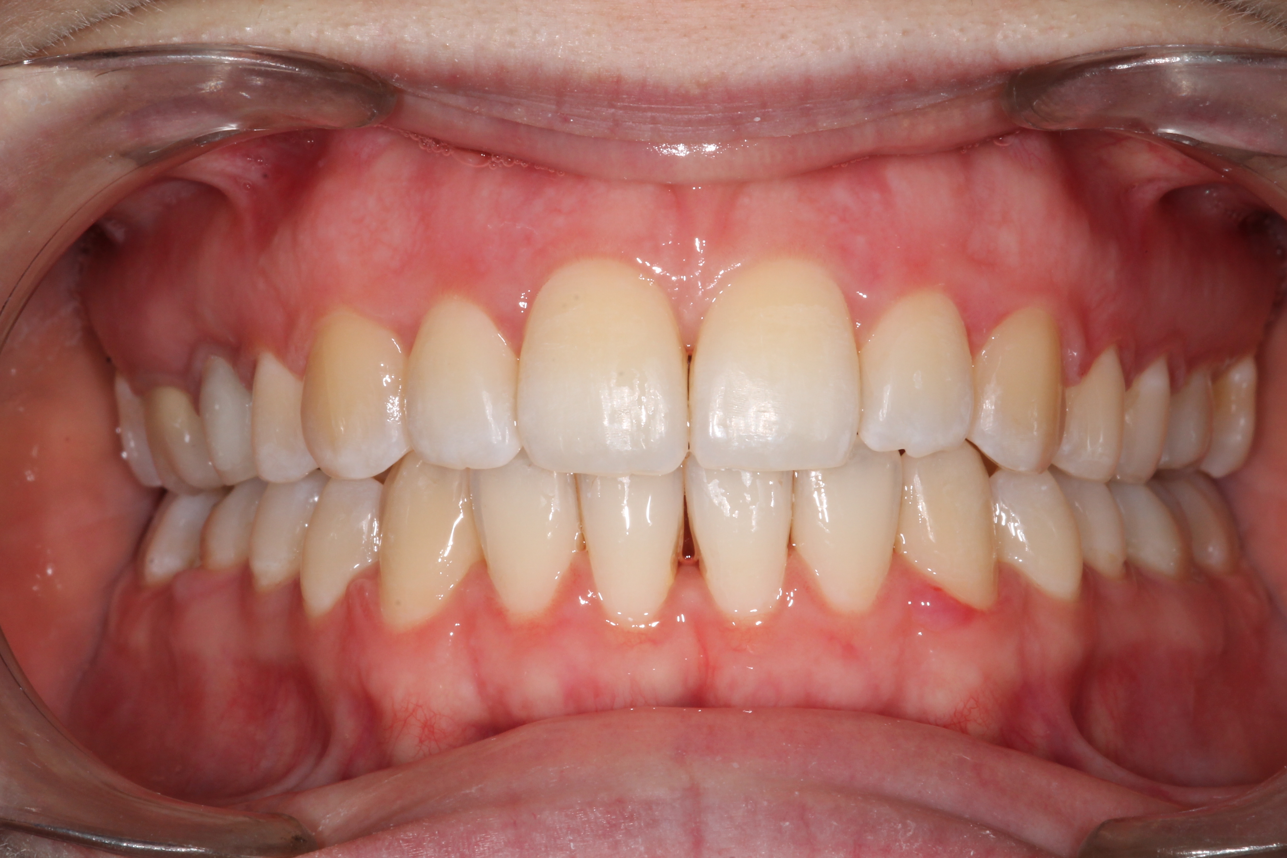 Photo ortho 2