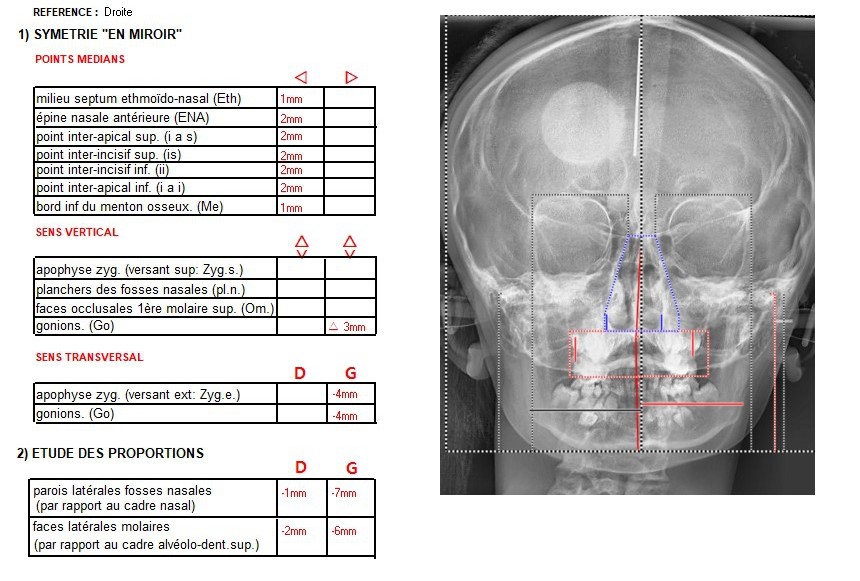 ResultatCephalo2