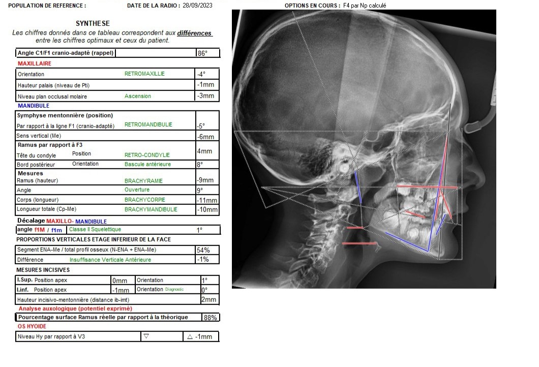 ResultatCephalo2
